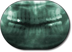 Panoramic X-ray